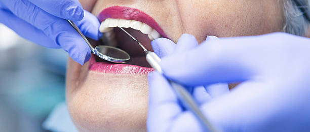 Best Chipped Tooth Repair Near Me  in Ridgefield, NJ